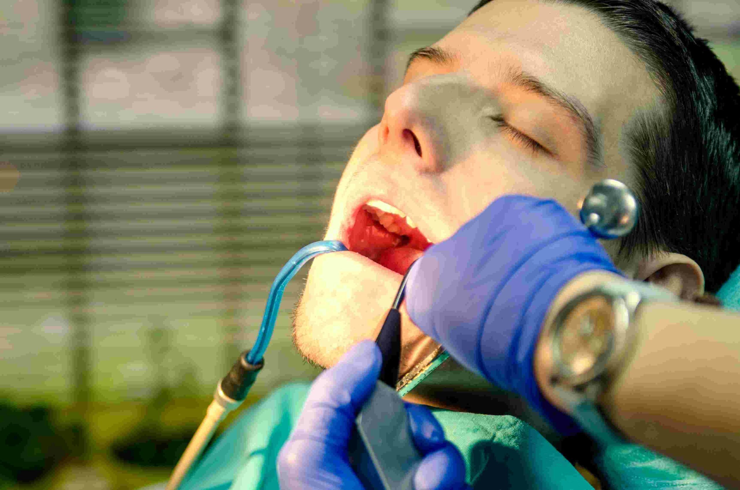 Penang Root Canal Costs: A Transparent Breakdown